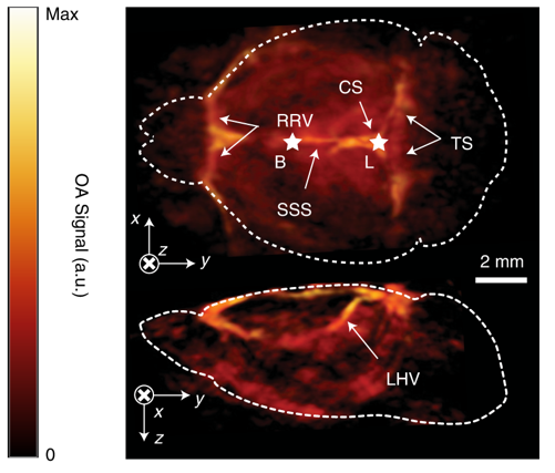Rapid volumetric optoacoustic imaging of neural dynamics across the mouse brain, Fig 3d